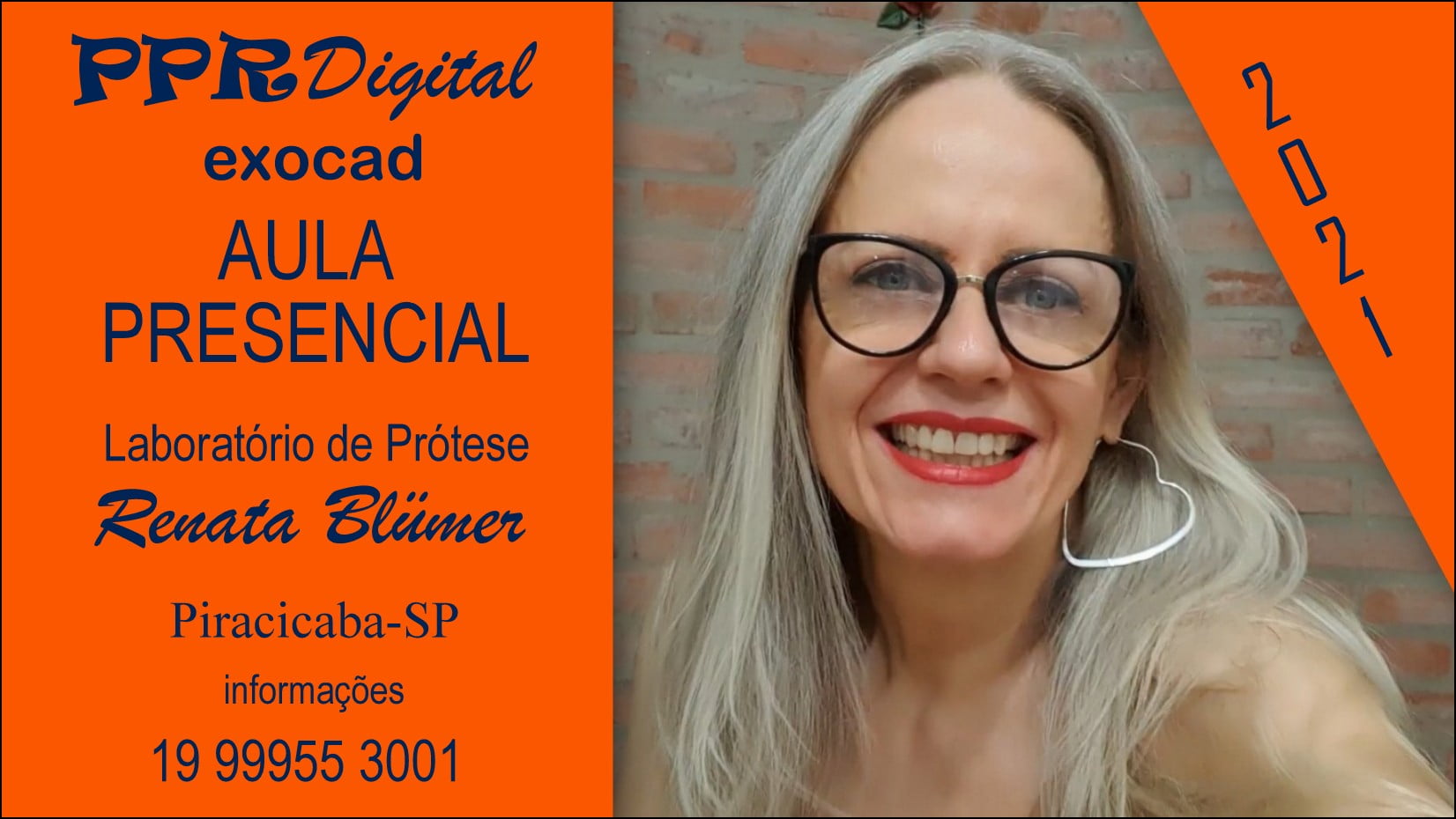 AULA PRESENCIAL PPR DIGITAL PLATAFORMA EXOCAD - LABORATÓRIO DE PRÓTESE RENATA BLUMER -( SOB - CONSULTA )