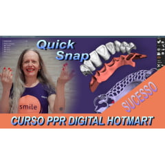 CURSO PPR DIGITAL QUICKSNAP EXOCAD - DENTES, GENGIVA E ESTRUTURA - HOTMART