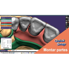 CURSO PPR DIGITAL QUICKSNAP EXOCAD - DENTES, GENGIVA E ESTRUTURA - HOTMART