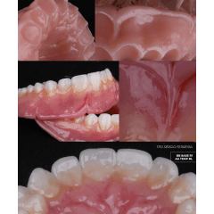 RESINA 3D ODONTOMEGA BASE DE PT PRINTAX BB BASE DE PT– DLP/ LCD – 500G 