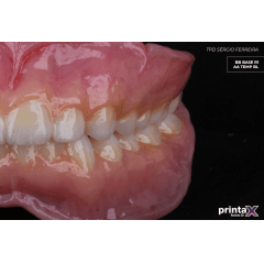 #ODONTOMEGA #RESINA3D #DENTALCREMER #IMPRESSORA3D #PRINTAX #AA #PROVISÓRIO